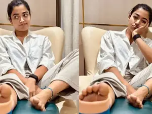 Rashmika Mandanna shares update on leg injury, apologises to her directors