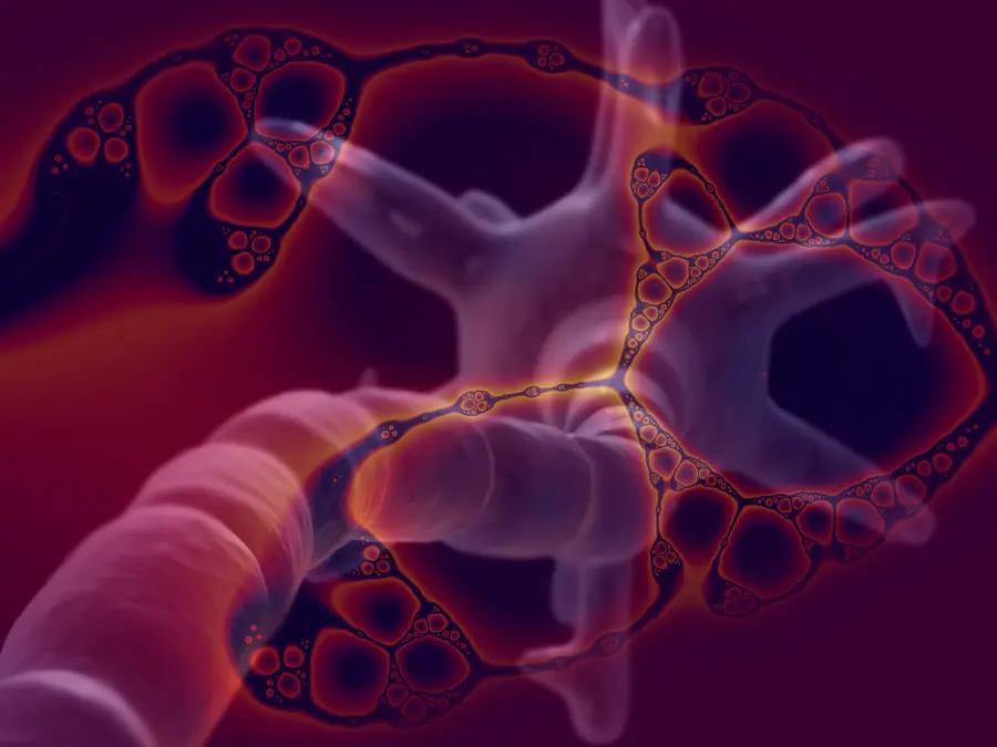 Mumbai reports first Guillain-Barré Syndrome death as cases rise in Pune