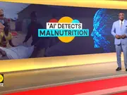 AI tool predicts where people are at risk of malnutrition