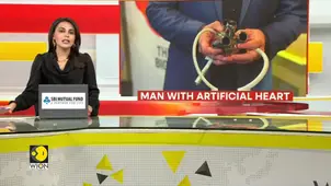 Man lives for 100 days with artificial heart; doctors hail big medical breakthrough