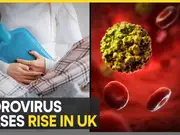 Norovirus cases surge in UK, NHS issues health advisory