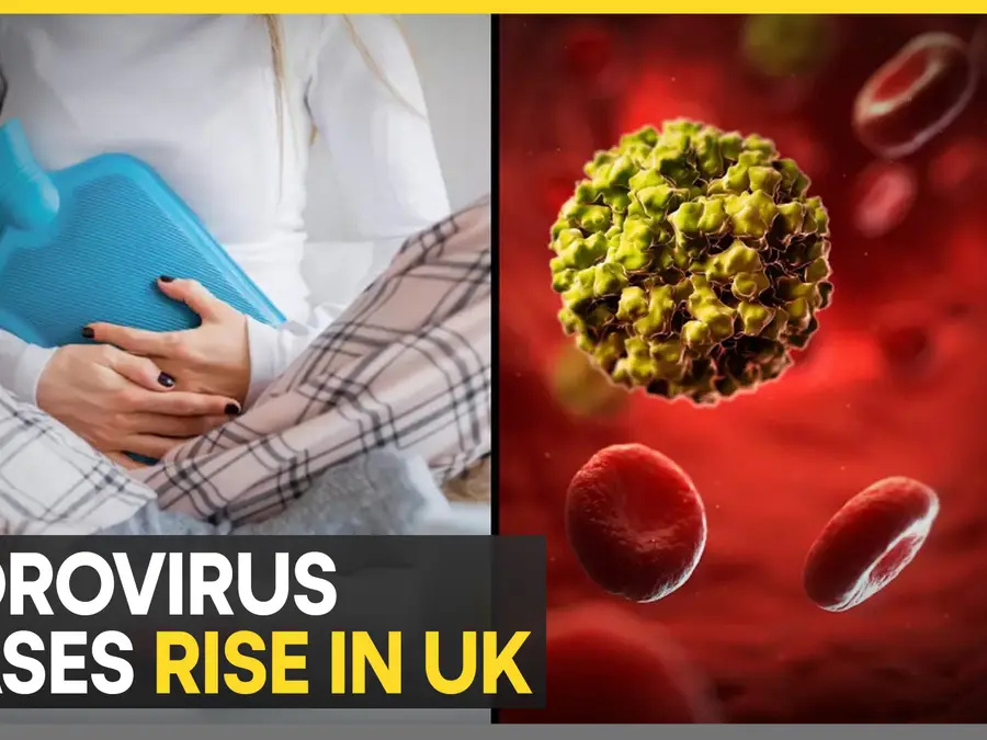 Norovirus cases surge in UK, NHS issues health advisory