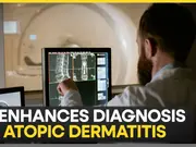 AI boosts accuracy of skin-related diagnosis