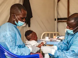 Mystery disease kills over 50 people in DR Congo - Know the symptoms