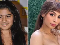 Khushi Kapoor admits getting cosmetic surgeries, says 'No big deal'