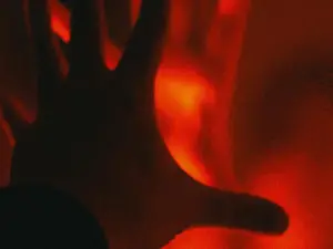 Australian man can't feel hot or cold because of a strange condition with no known cause and treatment