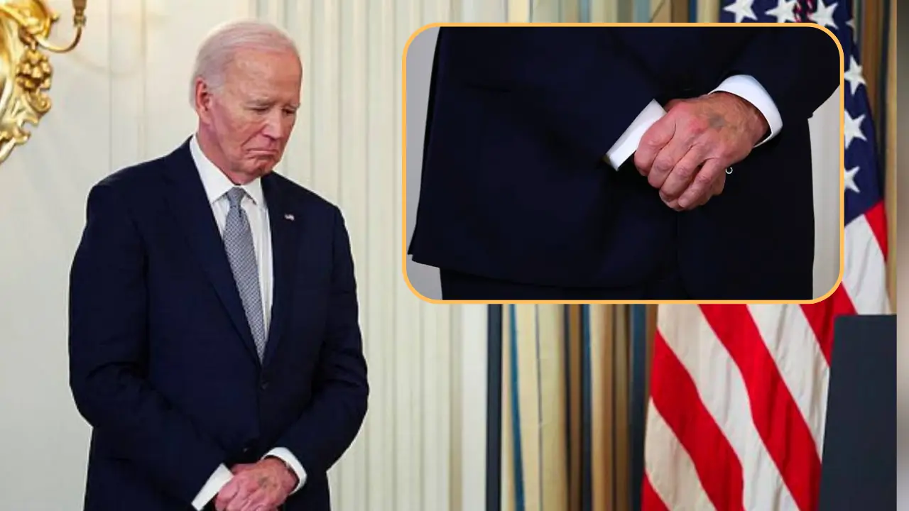 Watch: Joe Biden's mysterious purple bruise sparks speculation online