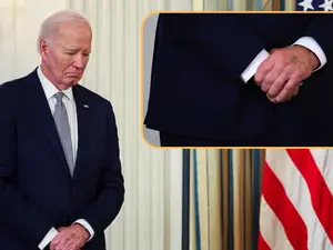 Watch: Joe Biden's mysterious purple bruise sparks speculation online