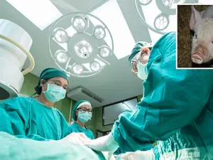 'It's a great achievement': Doctors successfully transplanted pig liver into human for the first time