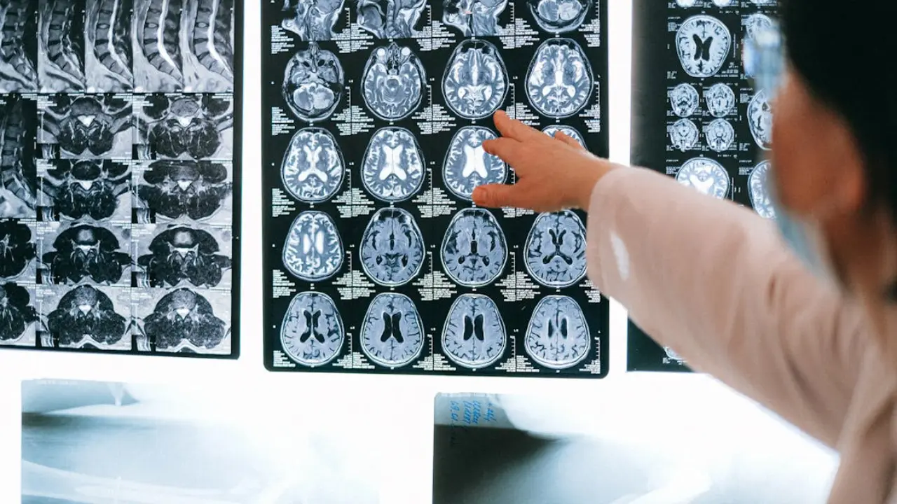 Your brain may start 'eating itself' during extreme endurance exercise, study finds