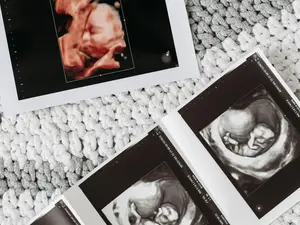 Horrific IVF mix-up leads Australian woman to give birth to stranger's baby