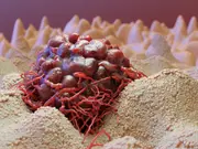 Can cancer be contagious? Surgeon 'catches' rare cancer from a patient