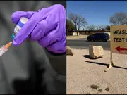 Measles outbreak in US: Third death reported as unvaccinated child dies in West Texas