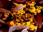 Virus linked to COVID-19 had travelled over 2,700kms before it was detected in Wuhan