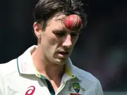 Pat Cummins doubtful for Champions Trophy 2025, hints George Bailey