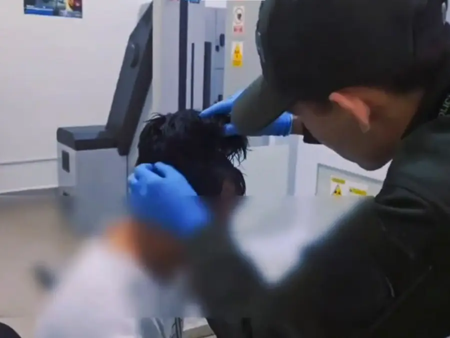 Watch | Colombian man arrested for trying to smuggle cocaine worth $10400 hidden in wig
