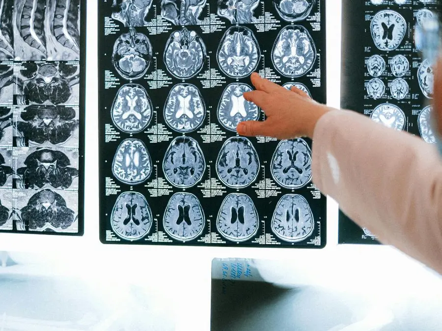 Common medicines may reduce risk of dementia, new study suggests