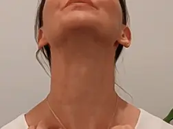 3-Minute Facial Yoga That Lifts Without Botox