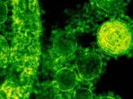 GBS outbreak claims two more lives in Pune, India death toll rises to 23
