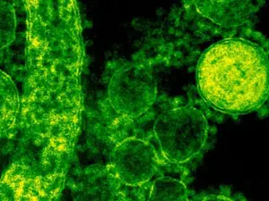 GBS outbreak claims two more lives in Pune, India death toll rises to 23