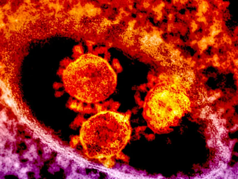 COVID-19 virus reaches 8-year-old girl's brain, putting her in coma before killing her COVID-19 virus reaches 8-year-old girl's brain, putting her in coma before killing her