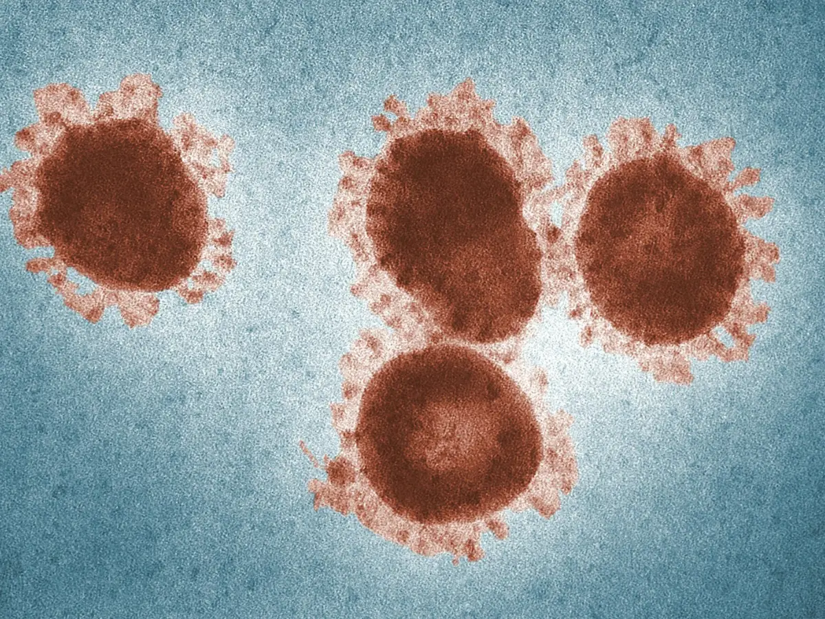 Arunachal Pradesh records first COVID-19 case, total active infections over 1,000 in India Arunachal Pradesh records first COVID-19 case, total active infections over 1,000 in India