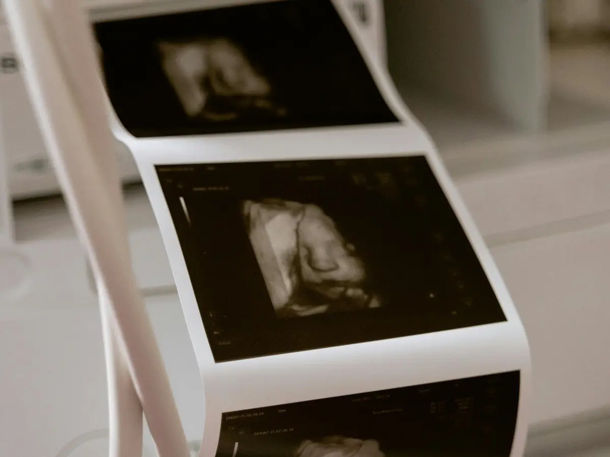  Mother says 'hand of God' popped up in ultrasound after her unborn baby was diagnosed with heart condition 