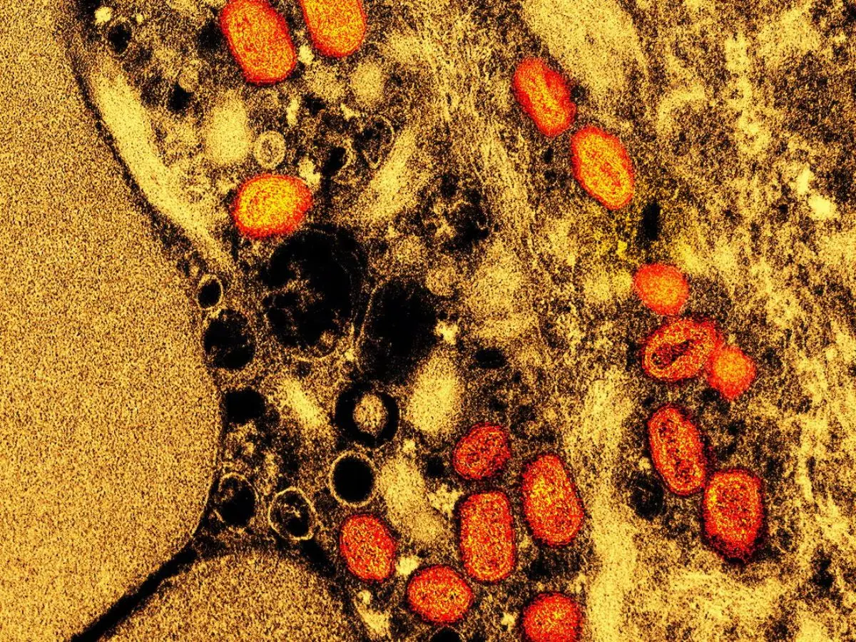 'Just one mutation away', COVID-19-like virus in China could spark outbreak: Study