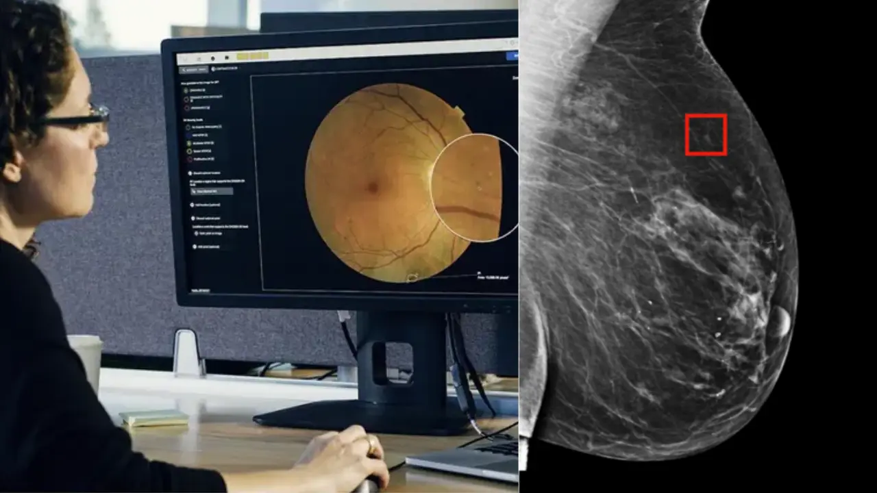Google says AI can help diagnose cancer early and support treatment