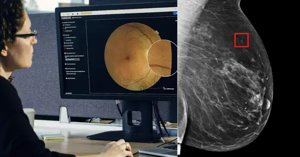 Google says AI can help diagnose cancer early and support treatment