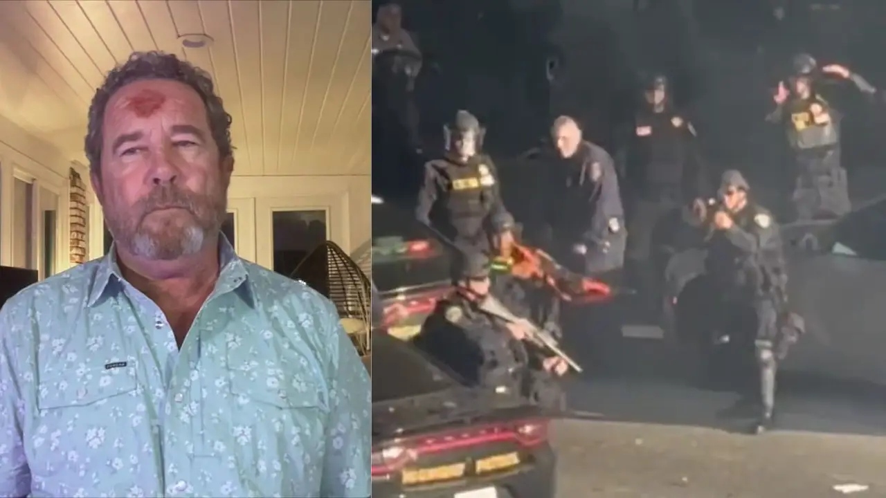 Cop 'directly aimed at me': American photojournalist shot on forehead with rubber bullet during LA protest recalls frightful moment