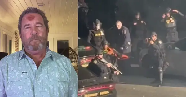 Journalist Shot with Rubber Bullet During LA Protest