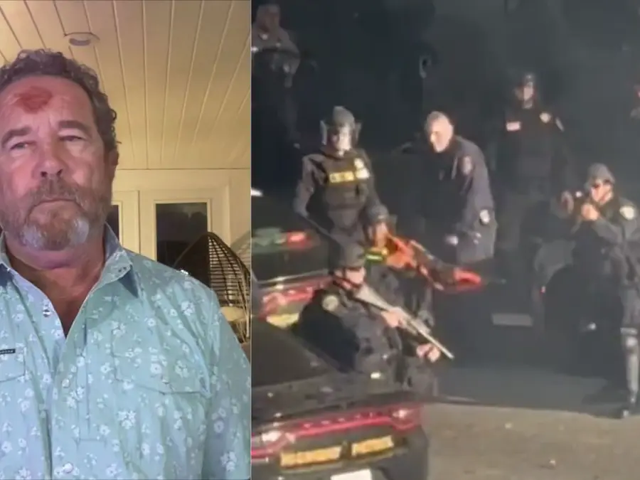 Cop 'directly aimed at me': American photojournalist shot on forehead with rubber bullet during LA protest recalls frightful moment