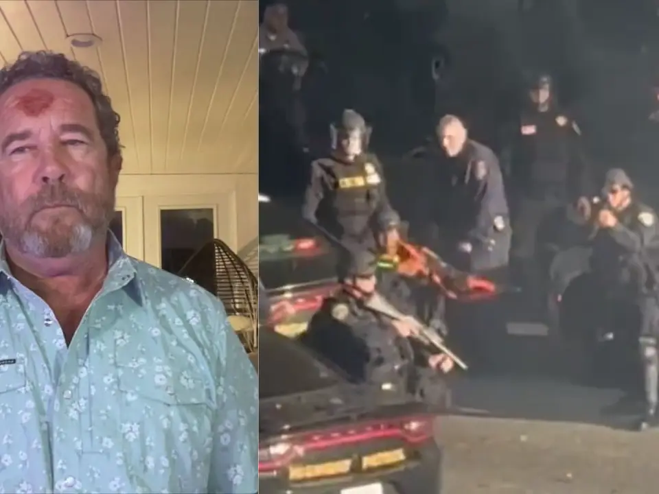 Cop 'directly aimed at me': American photojournalist shot on forehead with rubber bullet during LA protest recalls frightful moment Cop 'directly aimed at me': American photojournalist shot on forehead with rubber bullet during LA protest recalls frightful moment