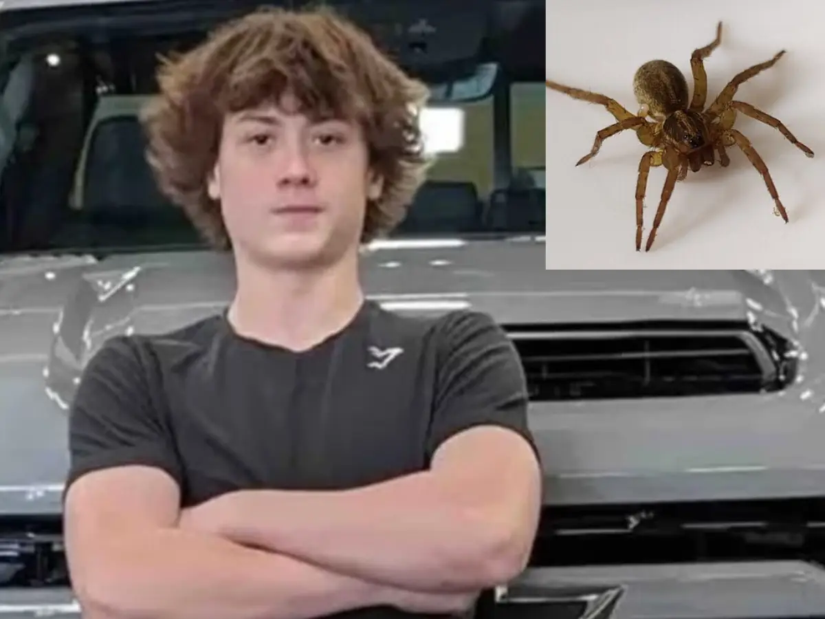 Spider bite leaves Iowa teen with kidney failure, unable to speak Spider bite leaves Iowa teen with kidney failure, unable to speak