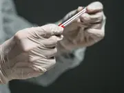 Man with no medical license injects toxic bleach mix into tumours for $20,000. He is eyeing US as his next market