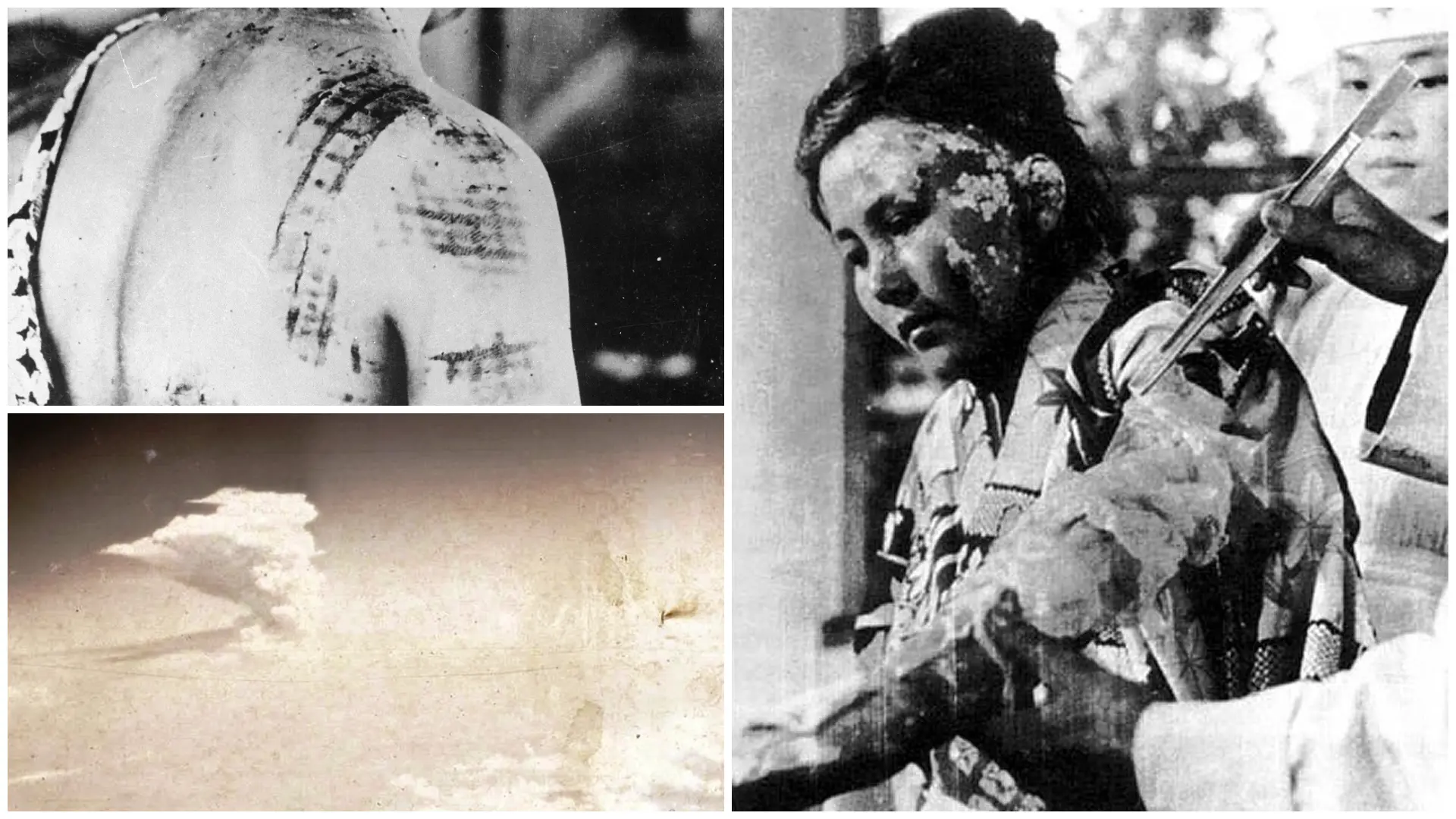 Hiroshima bombing: Long-term human impacts continue to this day