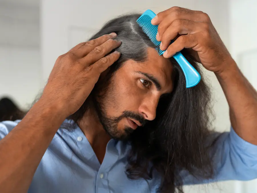 Hair Transplant: Myths vs Facts decoded by expert, know key parameters and procedures