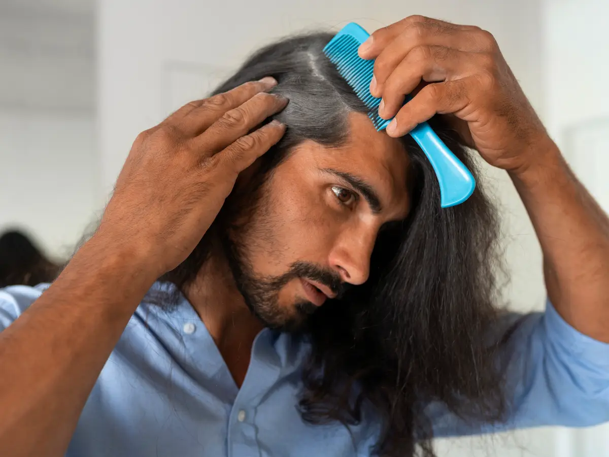 Hair Transplant Myths Debunked by Experts Using DHI