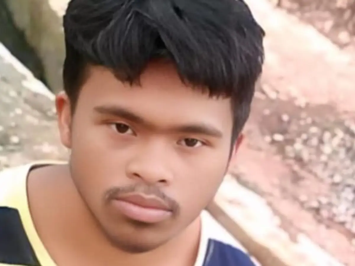Odisha Dog Attack: Rabies Kills Athlete, Farmer