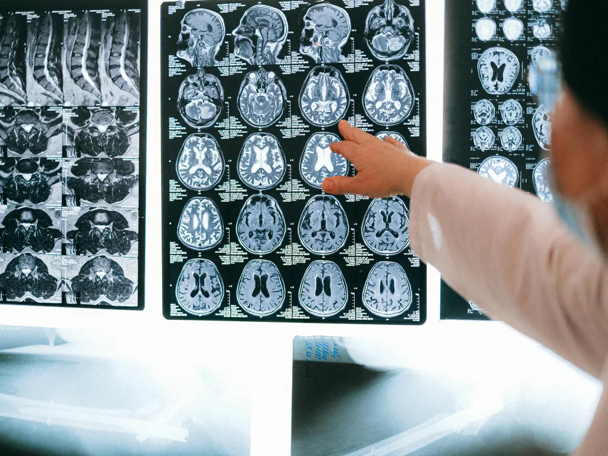 Alert sounded after Kerala girl dies of 'brain-eating amoeba' — How safe are you?  | WION Explains
