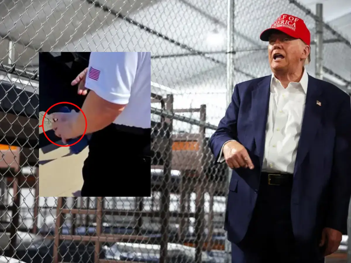 White House repeats bizarre 'shakes hands with people' theory over Trump's left-hand bruise - What his doctor said