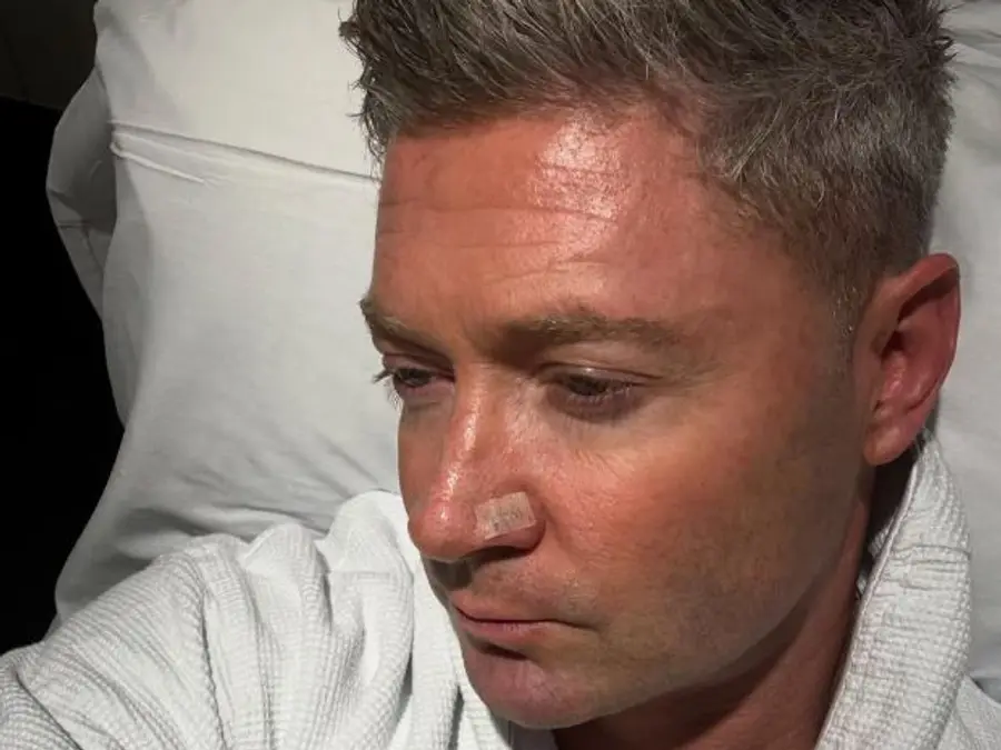 Former Australia captain Michael Clarke's battle with skin cancer continues after latest surgery