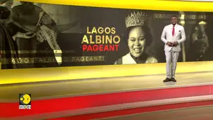 Nigeria’s albinism community gets its first beauty queen in Lagos 