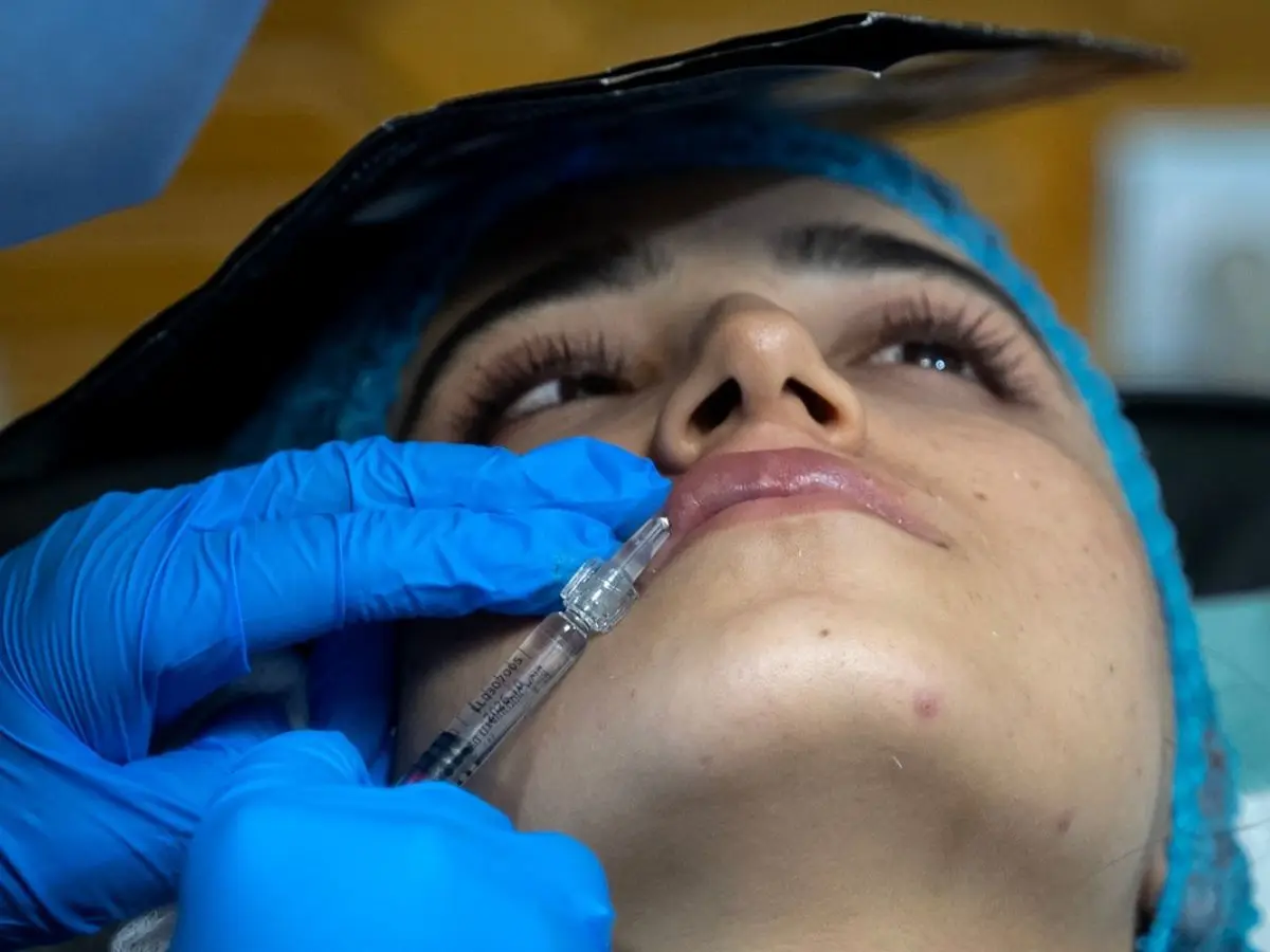 Botox under burqas, unlikely boom of cosmetic surgery in Taliban conservatism Botox under burqas, unlikely boom of cosmetic surgery in Taliban conservatism