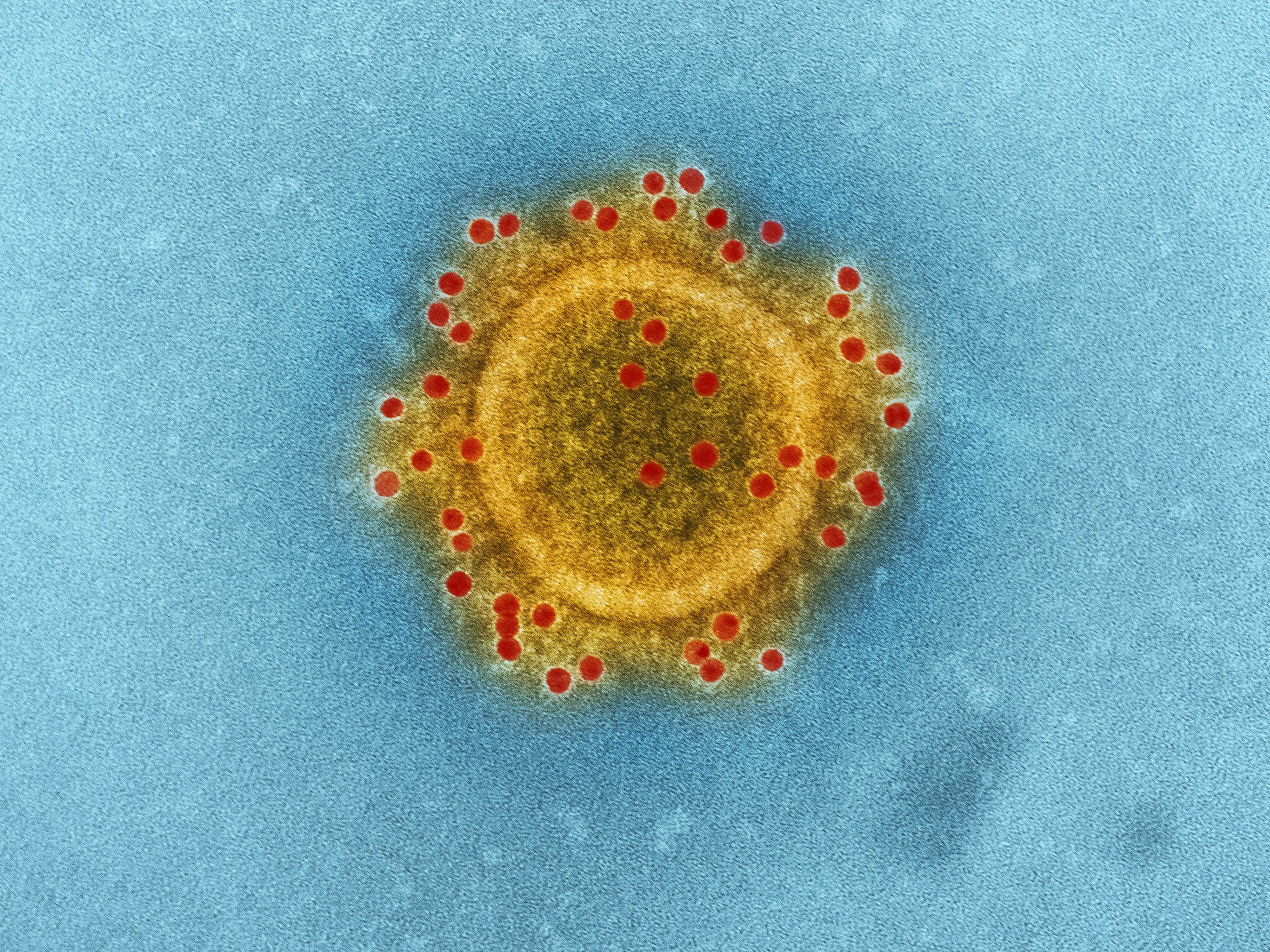 Kerala’s ‘brain-eating amoeba’ scare deepens: 3-year-old latest to be infected, death toll rises to 23 Kerala’s ‘brain-eating amoeba’ scare deepens: 3-year-old latest to be infected, death toll rises to 23