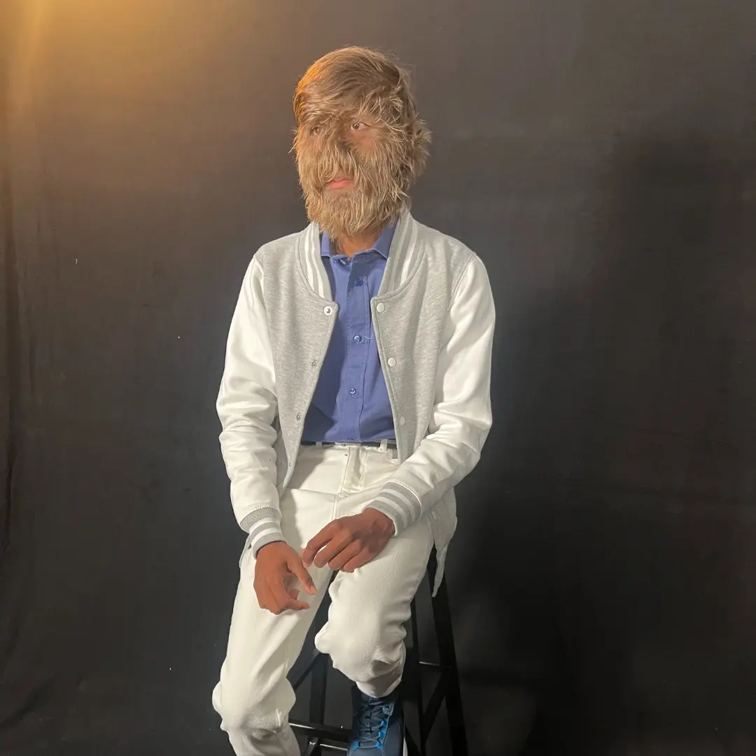 5. Hairiest face on a person (male)