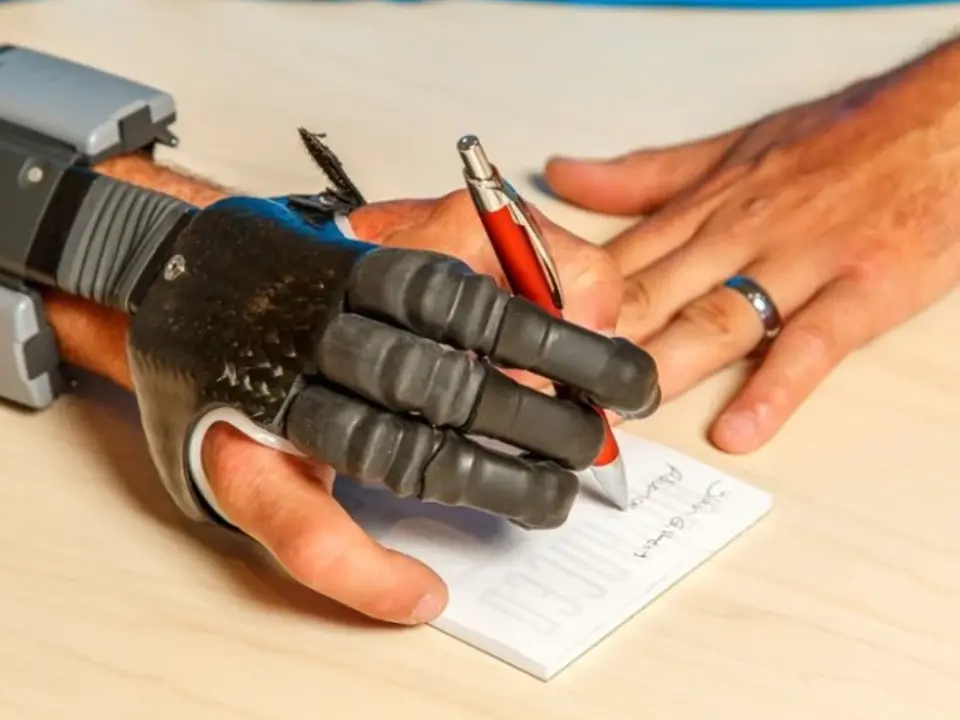 Why advanced bionic hands fail, and how AI is fixing the problem Why advanced bionic hands fail, and how AI is fixing the problem