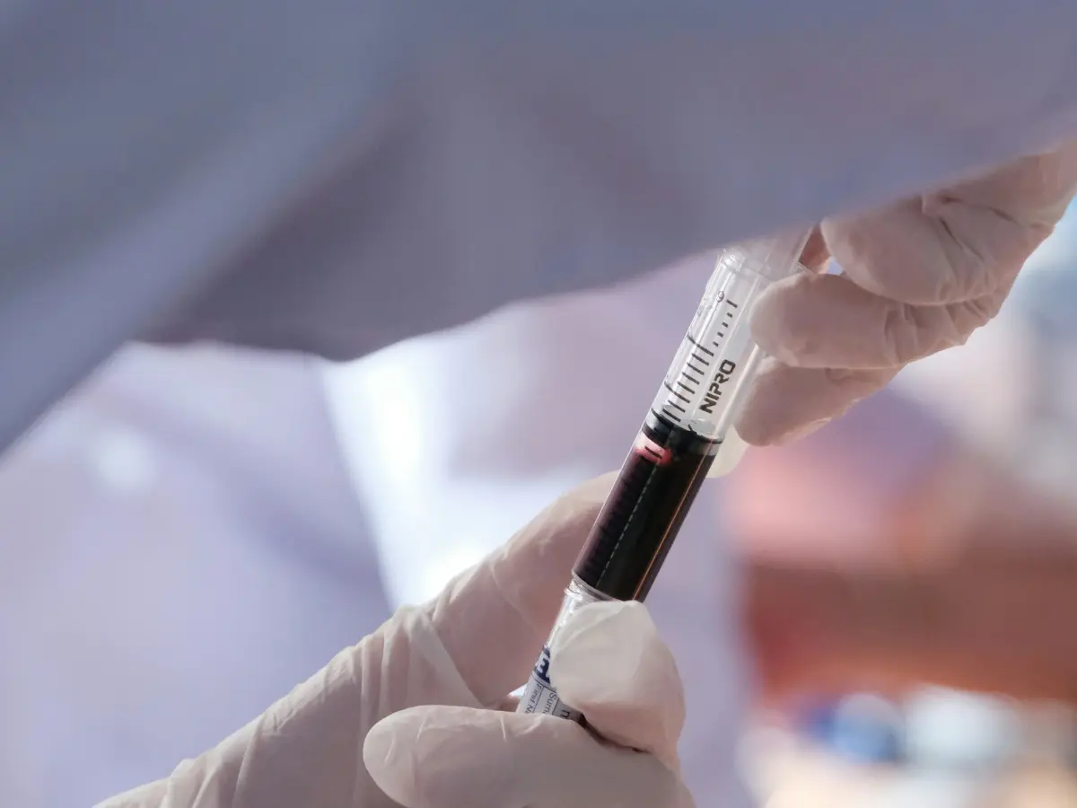 Brazilian Woman Found with Male Blood Chromosomes