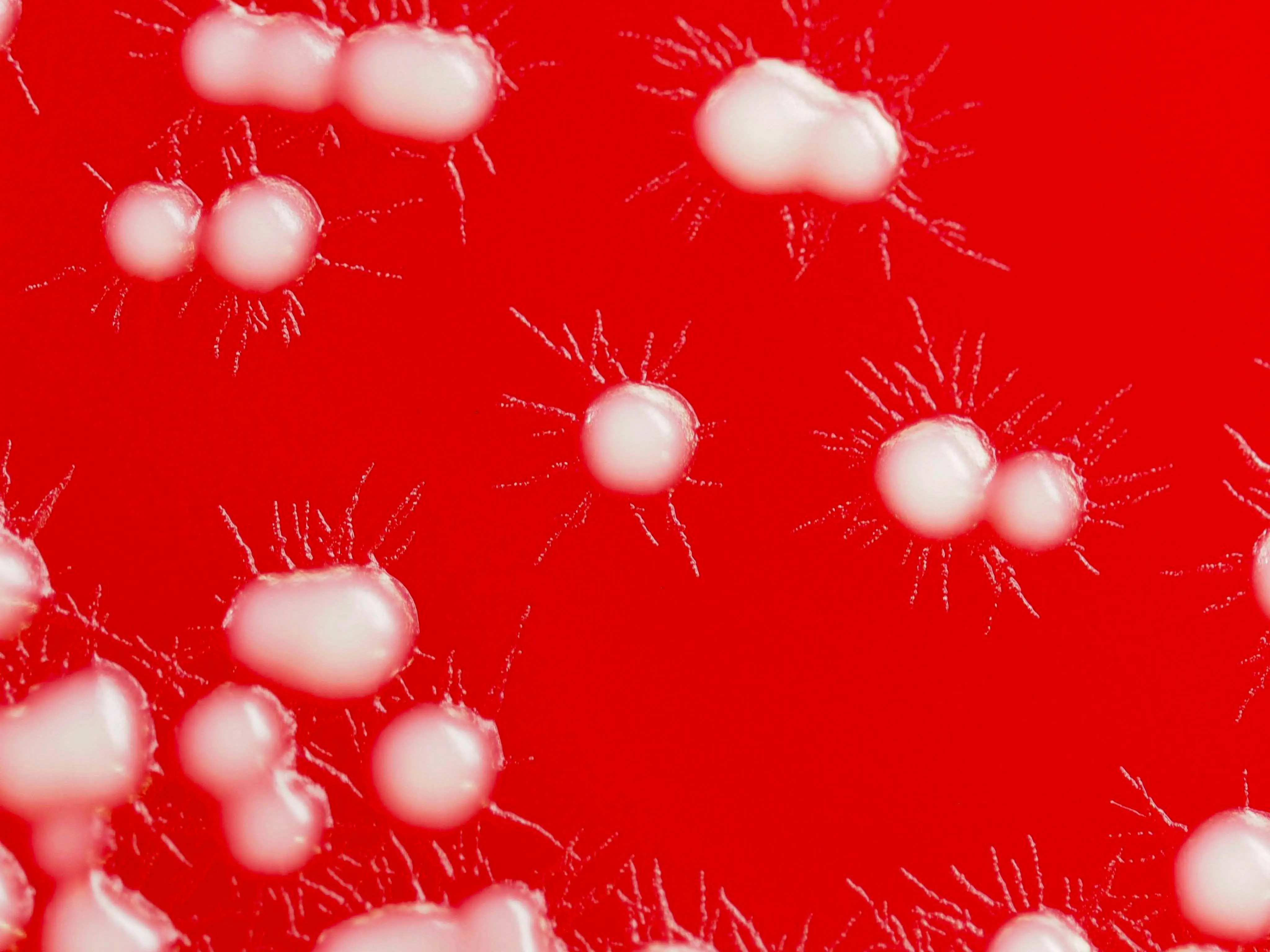 Lethal fungus resistant to drugs has picked up pace across the world, scientists warn